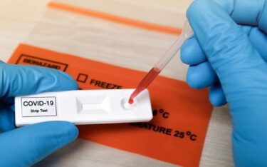 تست های پادتن کووید 19