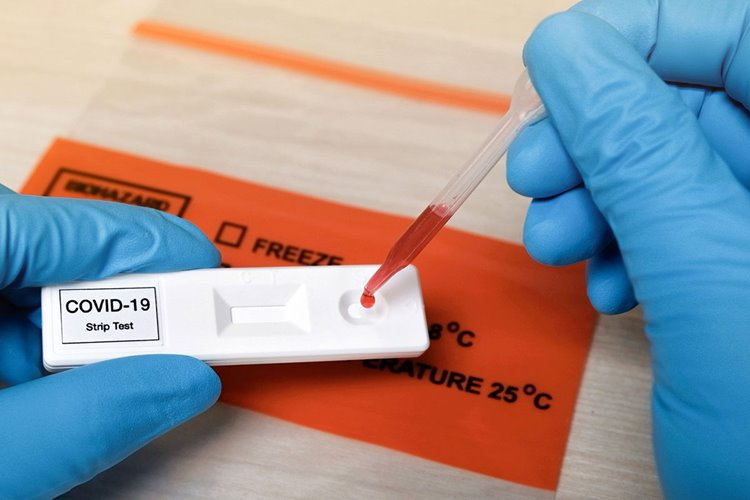 تست های پادتن کووید 19